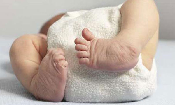clubfoot1.jpg